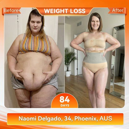 4-In-1 Sculpting & Fat-Burn Shorts